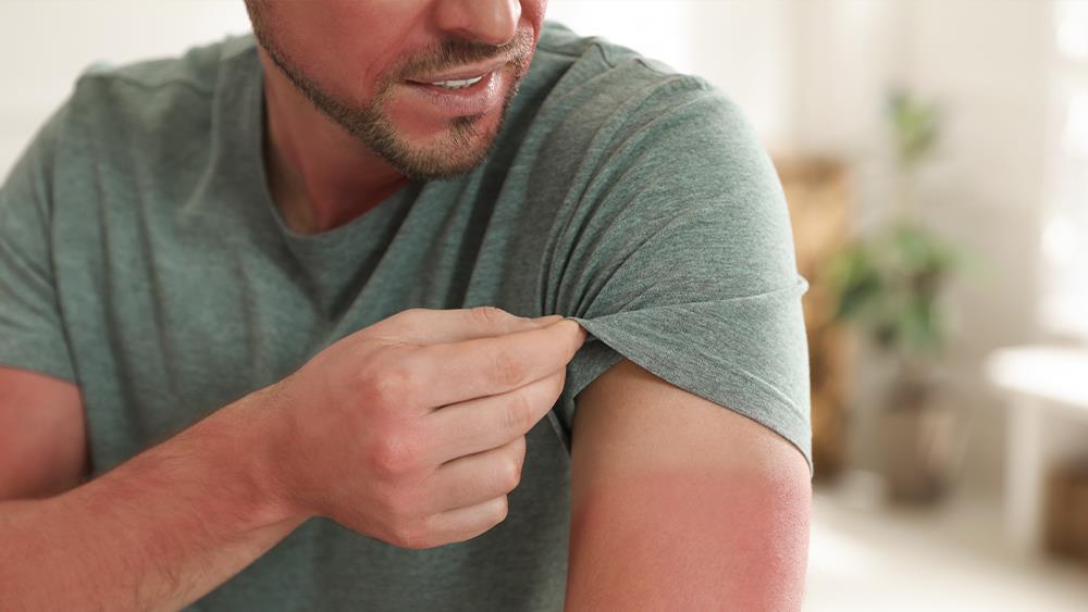 Toolstation and Macmillan launch Sunburn Swatch campaign image